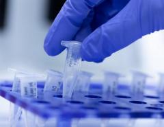 Șase decese în Washington provocate de coronavirus