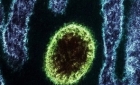 Alertă maximă în China: Henipavirus un nou virus de origine animală a fost descoperit la oameni. Zeci de cazuri de infectare!