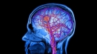Care sunt bolile si obiceiurile care duc la imbatranirea cerebrala