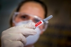 Cercetatori britanici: Un vaccin universal care să funcționeze împotriva tuturor variantelor coronavirusului ar fi disponibil într-un an