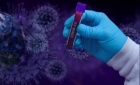 Cum ar fi ajuns noul coronavirus la om și care sunt concluziile echipei de ancheta a OMS
