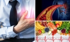 Dieta care previne infarctul si alte afectiuni cardiace si vasculare