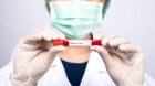 Document IN ORIGINAL al Ministerului german de Interne: Pandemia a fost o ALARMA FALSĂ la nivel global!