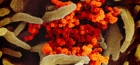 Olandezii încearcă "decaparea" proteinei SPIKE din coronavirus SARS-C0V 2