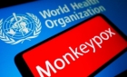 Reuniune de urgență a OMS: variola maimuței se răspândește prea repede!