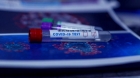 Tehnica PCR Multiplex: Italia a dezvoltat un test rapid care identifică trei tulpini Covid în două ore