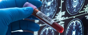 Alzheimer: Cât de departe au ajuns cercetătorii în căutarea unui leac pentru cumplita boală a secolului