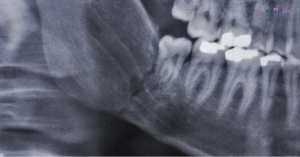 Radiologia dentară: Cum te ajută să ai grijă de sănătatea ta orală?