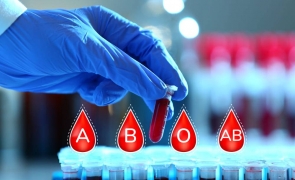 Riscul unui accident vascular cerebral diferă în funcție de grupa sanguină. Care este grupa cea mai predispusă unui AVC