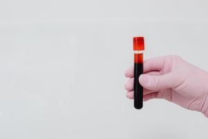 Sfaturi pentru a învinge anemia și a-ți recăpăta pofta de viață