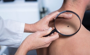 SUA revoluționează lumea medicală: un medicament care tratează cancerul de piele în formă avansată a fost aprobat