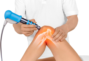 Terapia Shockwave - în ce situații medicale își dovedește eficiența?