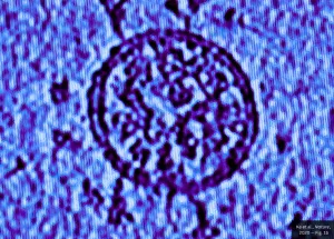 The Lancet: Proteina Spike a COVID-19 produce singură puține reacții acute la oameni. Ele cresc la 95% doar după adăugarea altor componente ale vaccinului