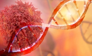 Tratament împotriva cancerului cu rezultate promițătoare: reduce riscul de recidivă cu 25%