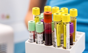 Descoperirea care revoluționează medicina modernă: o bacterie transformă sângele în grupa sanguină universală 0(1)