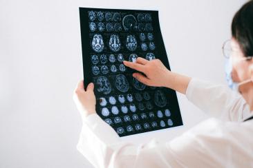 Pandemia ne-a îmbătrânit mintea: Efecte neurologice severe au fost observate și la cei neinfectați cu COVID-19