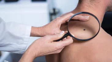 Un medic italian susține că razele solare nu cauzează cancer și că produsele de protecție solară sunt inutile: OMS a luat foc
