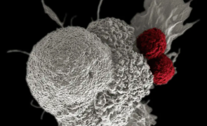 Revoluționar - Un test de sânge care depistează precoce cancerul ar putea scuti bolnavii de chimioterapie
