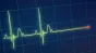 Ce se întâmplă în mintea omului la granița dintre viață și moarte: 18% dintre supraviețuitorii unui stop cardiac au raportat experiențe "de pe lumea cealaltă"