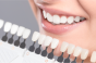 Cum să îți îmbunătățești aspectul dinților?
