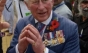 Curiozitatea dezvăluită de medici: Regele Charles naște speculații din cauza degetelor-cârnați
