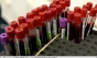 Descoperire revoluționară făcută de cercetători: O singură doză dintr-o nouă clasă de antibiotice a tratat infecțiile din sânge în doar 4 ore
