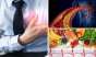 Dieta care previne infarctul si alte afectiuni cardiace si vasculare