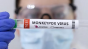 OMS organizează o întâlnire de urgență în legătură cu variola maimuței pentru a stabili dacă este vorba de "o urgență de sănătate publică de interes internațional"

