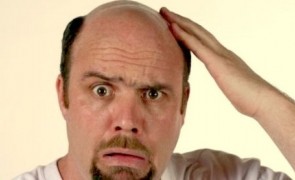 Adio, chelie! Americanii au aprobat primul medicament împotriva alopeciei