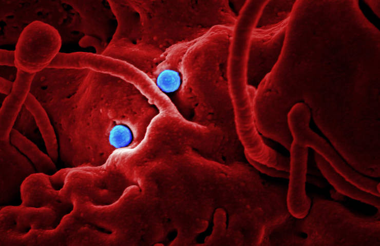 Anunț apocaliptic din China: Un nou tip de coronavirus cu rată mare de deces și infecție. NEO-COV este un MERS-COV2!