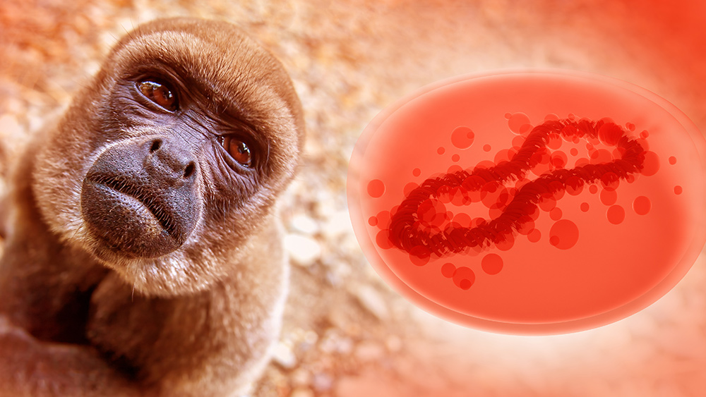 CDC avertizează asupra unei posibile reapariții a epidemiei de variola maimuței în această vară - majoritatea cazurilor noi sunt la persoane vaccinate împotriva bolii

