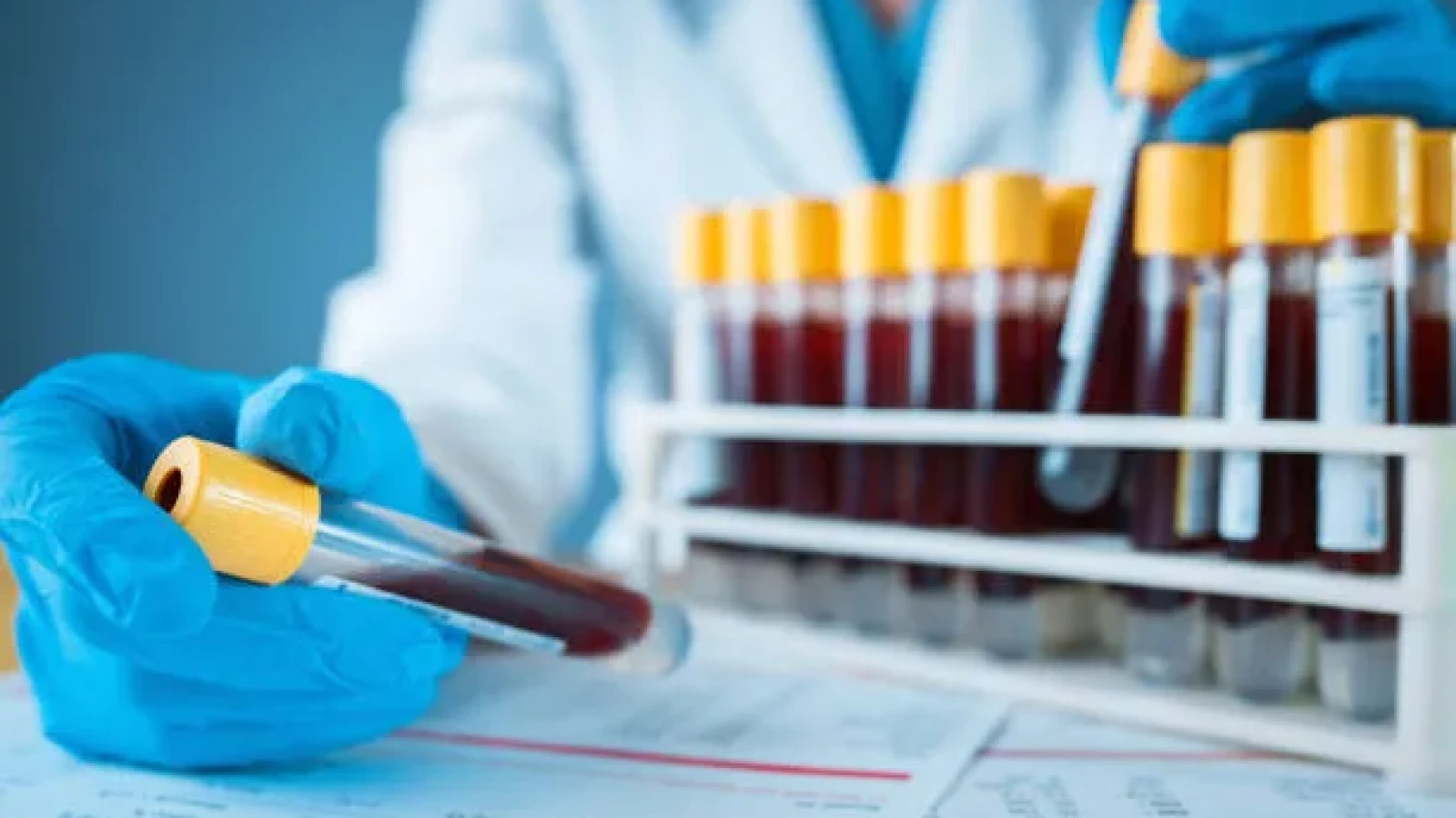 Creșterea nivelului de dioxid de carbon din aer modifică sângele uman: Nu spunem că oamenii se vor îmbolnăvi brusc