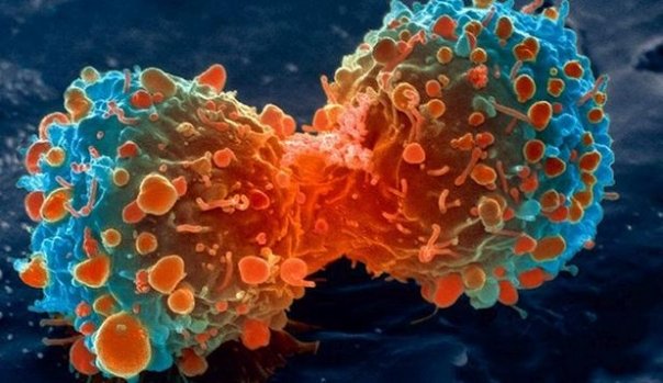 Cum putem preveni cancerul? - 10 metode eficiente si simplu de urmat