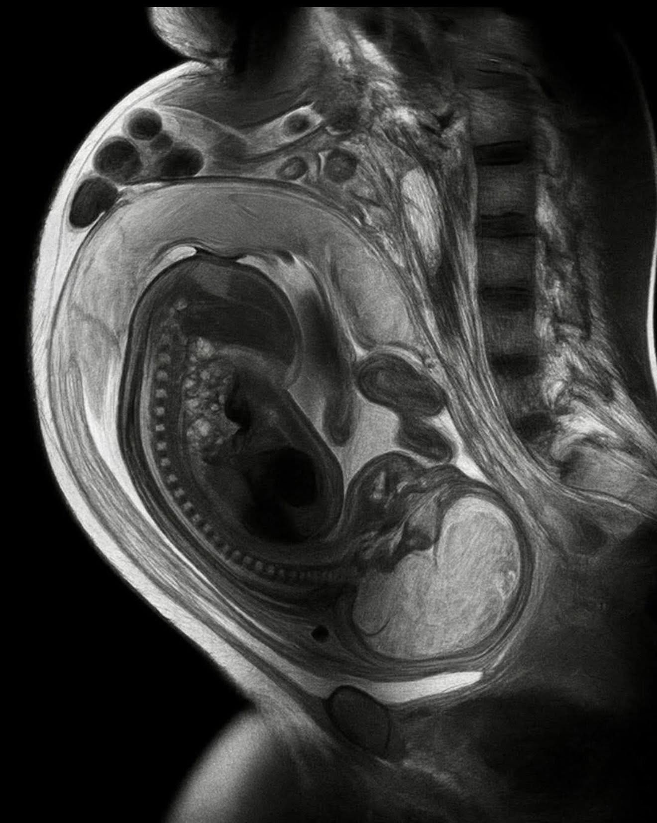Descoperire epocală dintr-un plan divin al creatiei: Celulele fătului trec prin placentă și vindecă bolile mamei. Celulele mamei trec la făt și se instaleaza in creier permanent