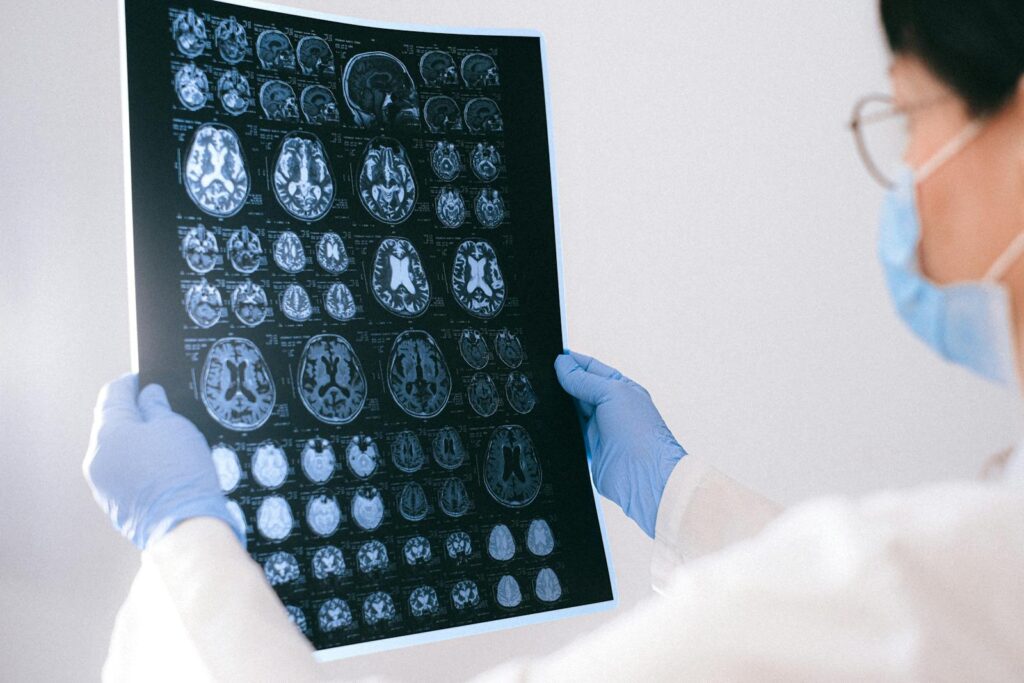Descoperire revoluționară: Blocarea morții celulare deschide calea spre tratarea bolilor neurodegenerative, inclusiv Parkinson și Alzheimer