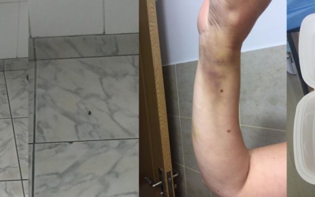 Femeia cu căpuşa a ajuns la spital: