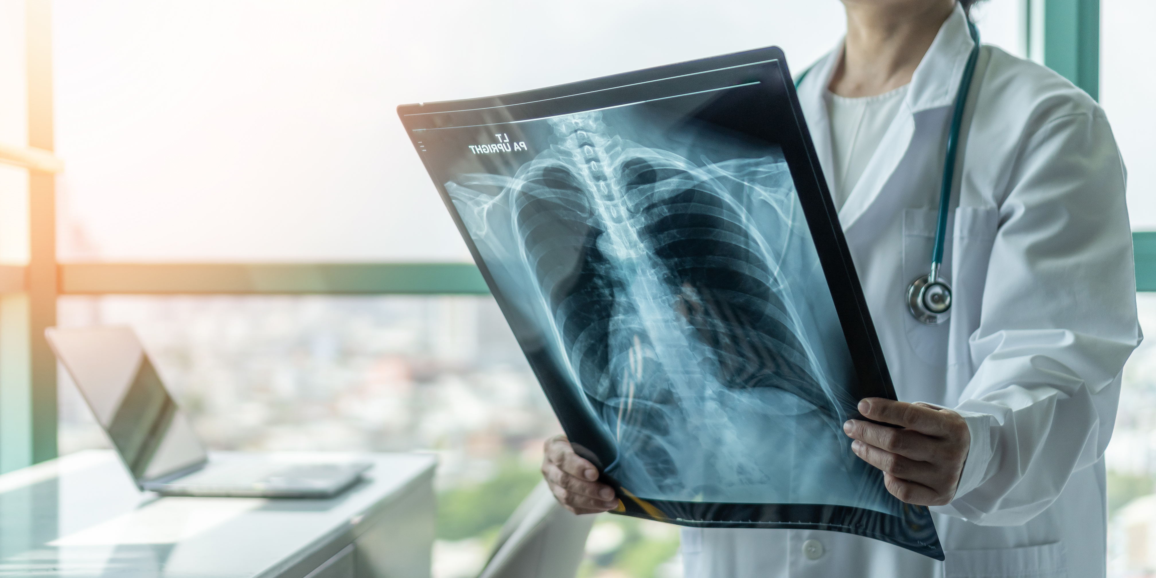 Hiperstimularea in cazul vaccinului anti-Covid poate declansa o furtuna imunologica cu consevinte foarte grave