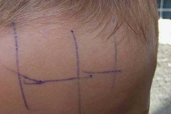 Incredibil la o grădiniţă din Gorj: un copil de 4 ani a fost scris cu pixul pe faţă pentru a fi pedepsit!