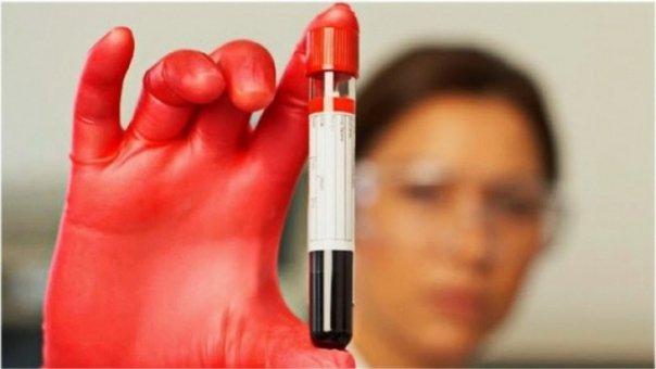 Misterul grupelor sanguine a fost dezvaluit. Persoanele cu Rh negativ au trasaturi neobisnuite