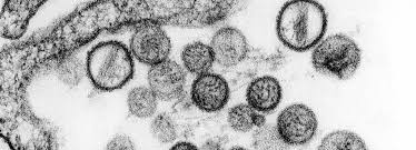 Nu era suficient coronavirusul! In China a aparut primul caz mortal de hantavirus, mai fatal decât Covid-19. Un barbat a murit ca secerat, in autobuz