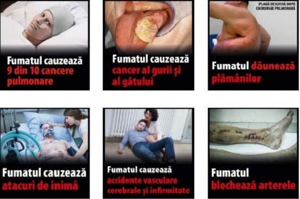 O familie de români va cere daune de milioane de euro pentru o poză de pe pachetele de ţigări
