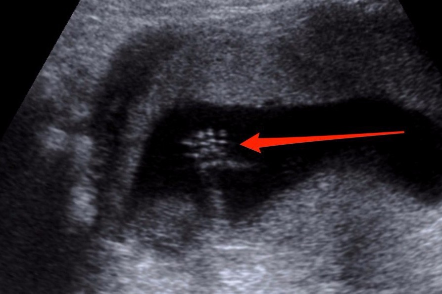 Oamenii de ştiinţă au făcut o descoperire care rescrie istoria evoluţiei umane