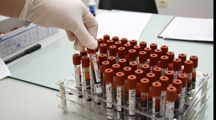 Premieră națională în tratamentul pacienților cu boli hematologice maligne
