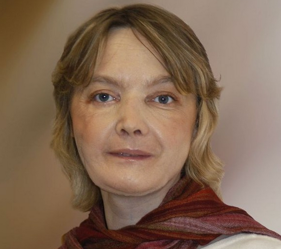 Prima femeie care a primit transplant de față a murit! Avea doar 49 de ani