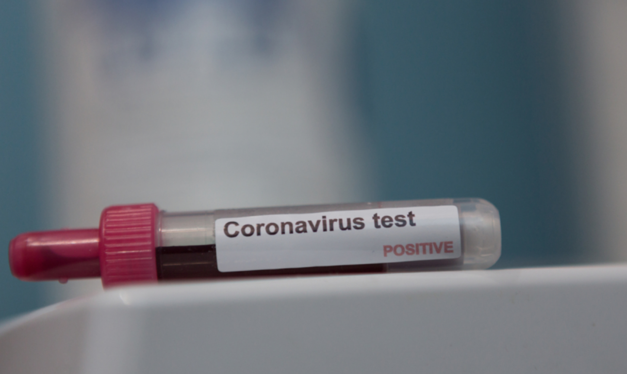 Romania a trecut de 1.000 de cazuri de coronavirus. Sunt 123 de noi confirmari si 29 de pacienti la Terapie Intensiva