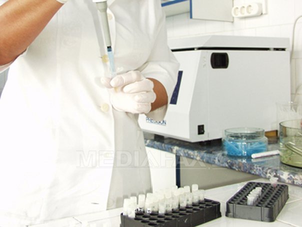 SIDA: 170.000 de români au intrat în contact cu Internet_HIV