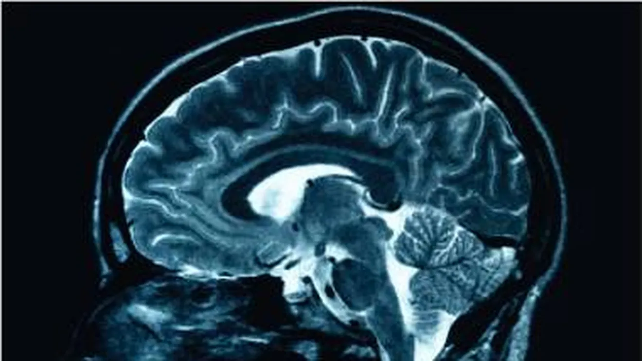 Surpriza factorului declanşator al bolii Alzheimer oferă și o modalitate de a-l neutraliza