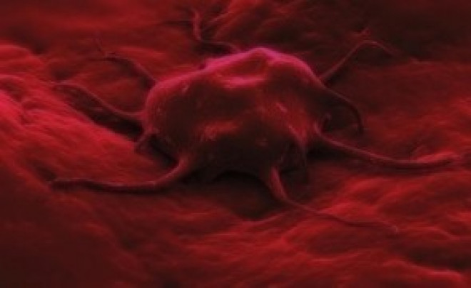 Teorie revoluţionară a oamenilor de ştiinţă: Cum apare cancerul