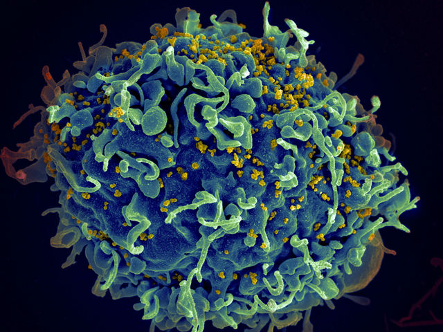 Un cercetator roman face o dezvaluire nimicitoare: SIDA e o inventie, nu exista!
