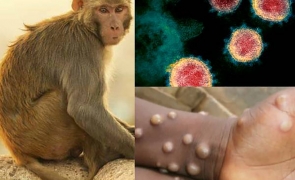 Variola maimuței lovește în Europa și SUA: nu există tratament pentru această boală!